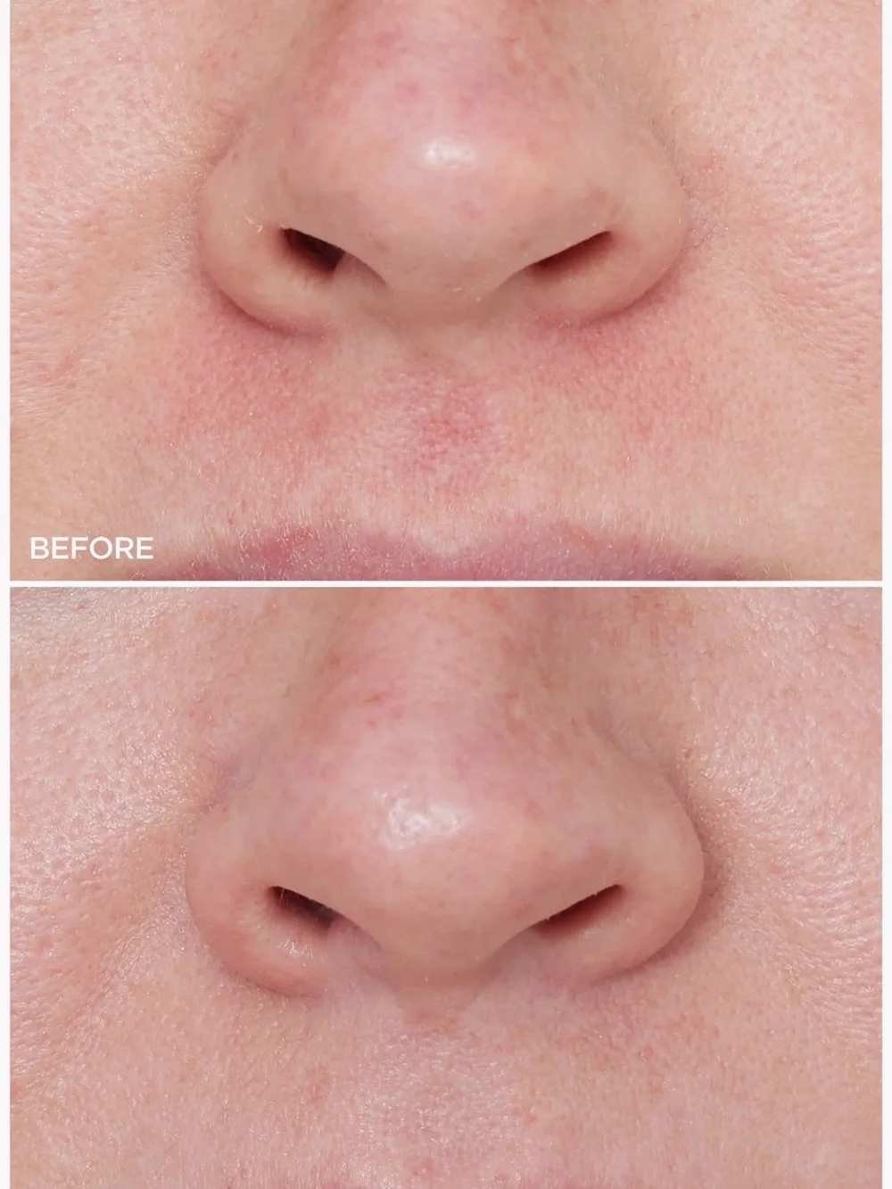 BeautyBio Bundle of The ZenBubble Bi-Phase Toner Serum & a 2fl of The Balance